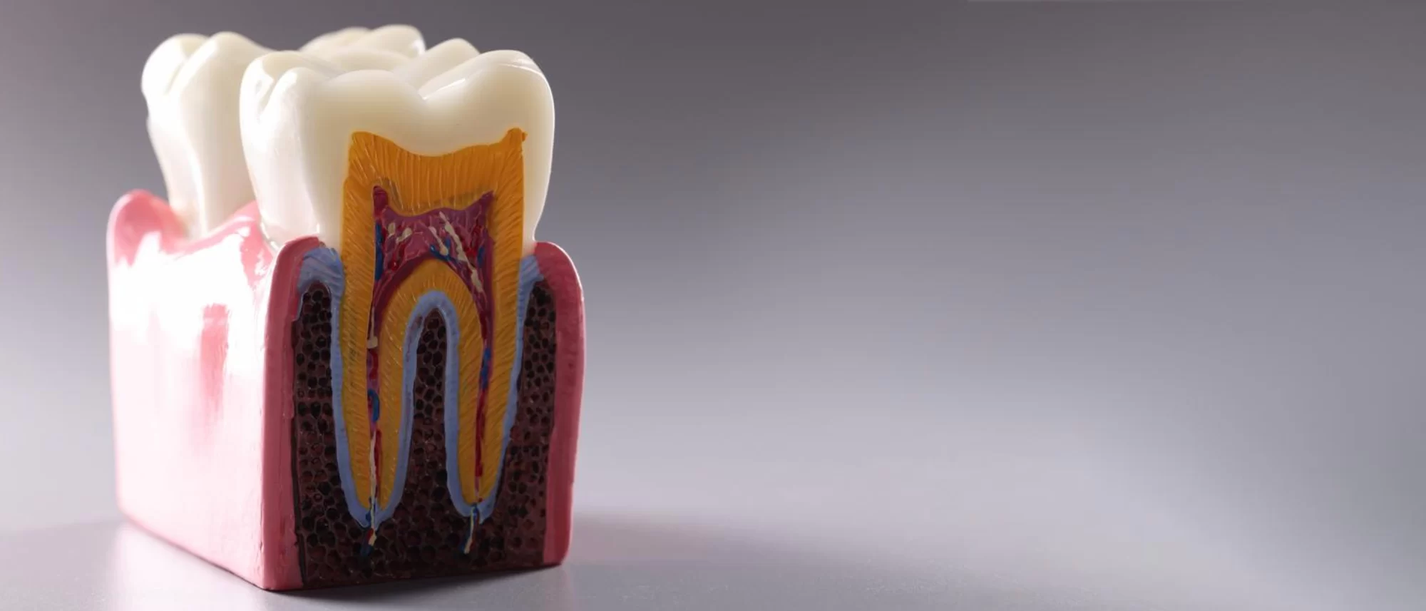 Root Canal Treatment